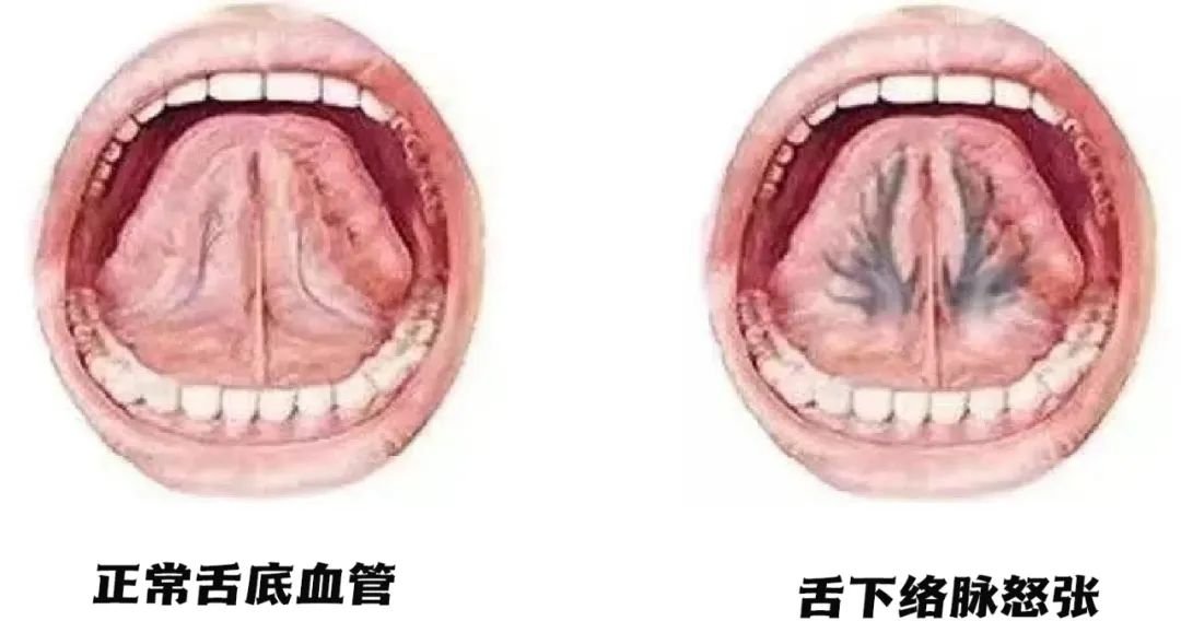血管清道夫,每天吃一点,让血管干干净净,血管干净人长寿 - 第3张 血管清道夫,每天吃一点,让血管干干净净,血管干净人长寿 - 第3张