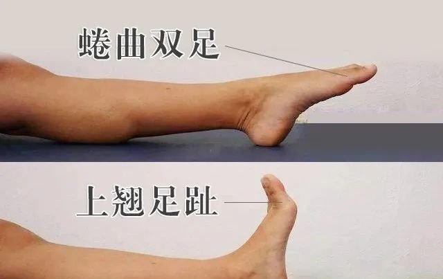 春养肝,趁着春天把这里揉通,肝血足了,眼睛亮了,睡眠好了 - 第5张 春养肝,趁着春天把这里揉通,肝血足了,眼睛亮了,睡眠好了 - 第5张