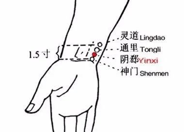 牢记全身疾病特效穴，专穴专用！ - 第10张