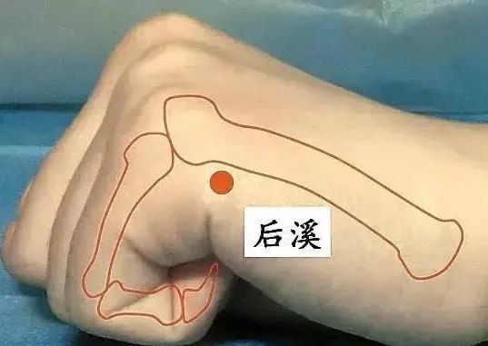 牢记全身疾病特效穴，专穴专用！ - 第25张