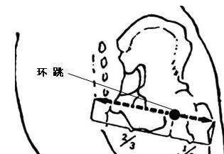 臀部一堵，全身受苦，艾灸保养臀部，打通上下开关 - 第6张