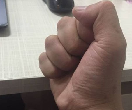 这个奇效大穴,通治一切颈肩腰椎病,艾灸它,百试百灵 - 第3张 这个奇效大穴,通治一切颈肩腰椎病,艾灸它,百试百灵 - 第3张