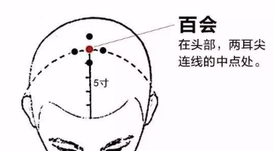 通气血，生黑发，最好的方法是从现在开始多灸头部 - 第3张