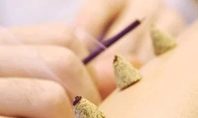 被遗忘的直接灸,被遗忘的强力效果! - 第2张 被遗忘的直接灸,被遗忘的强力效果! - 第2张