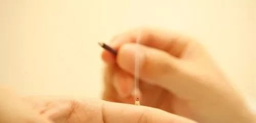 被遗忘的直接灸,被遗忘的强力效果! - 第3张 被遗忘的直接灸,被遗忘的强力效果! - 第3张