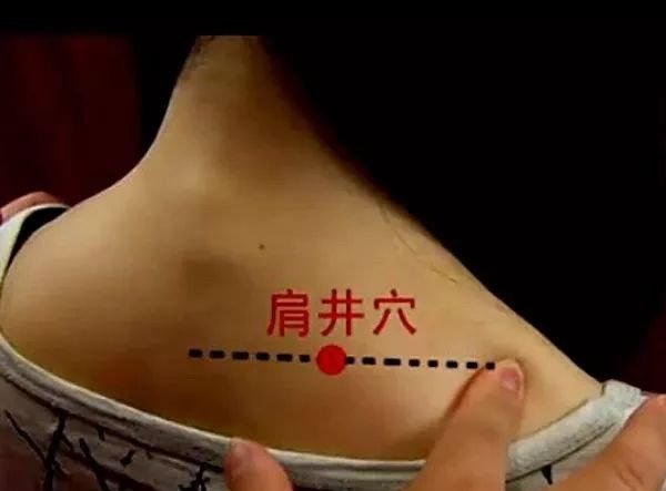 颈肩问题,久灸不断根,你可能忘了这关键一步 - 第8张 颈肩问题,久灸不断根,你可能忘了这关键一步 - 第8张