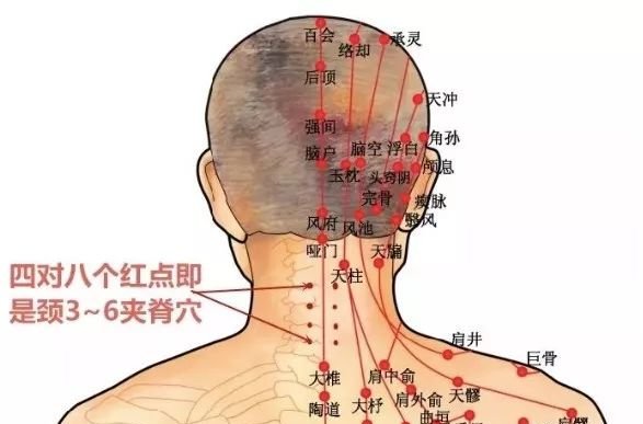 颈肩问题,久灸不断根,你可能忘了这关键一步 - 第9张 颈肩问题,久灸不断根,你可能忘了这关键一步 - 第9张