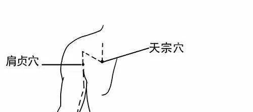 根治颈椎病的秘诀：灸通一经四穴，解开阎王锁！ - 第5张