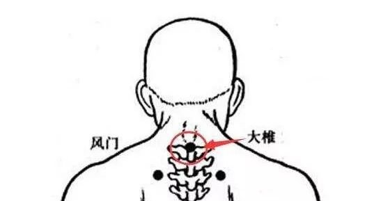 根治颈椎病的秘诀：灸通一经四穴，解开阎王锁！ - 第7张