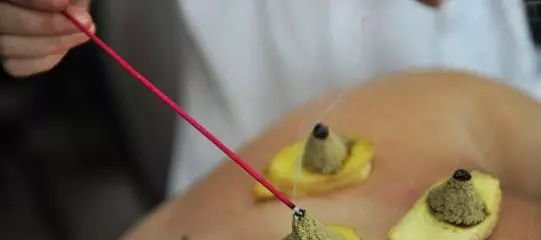 这个穴位,真的不能艾灸吗? - 第4张 这个穴位,真的不能艾灸吗? - 第4张