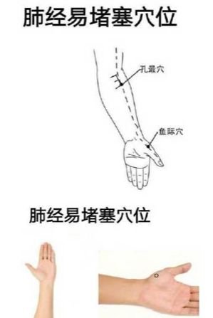 经络处方大公开,各类疾病自我搞定 - 第5张 经络处方大公开,各类疾病自我搞定 - 第5张