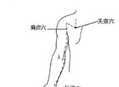 经络处方大公开,各类疾病自我搞定 - 第19张 经络处方大公开,各类疾病自我搞定 - 第19张