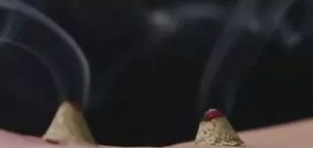 肾俞虽好,灸错了亦可酿成大过(附案例) - 第3张 肾俞虽好,灸错了亦可酿成大过(附案例) - 第3张