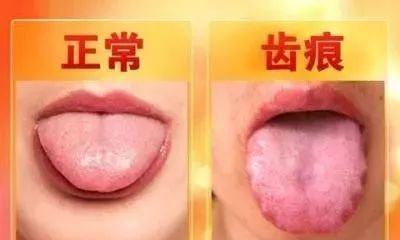 总胸闷气短,喉痒出虚汗?这种怪病闻所未闻,却最爱缠女人 ! - 第2张 总胸闷气短,喉痒出虚汗?这种怪病闻所未闻,却最爱缠女人 ! - 第2张