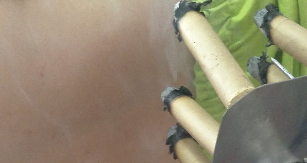 艾灸后出红疹,不是坏事,反而是一件大好事! - 第2张 艾灸后出红疹,不是坏事,反而是一件大好事! - 第2张