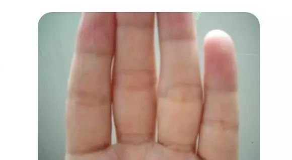 胖人补气,瘦人补血,不论胖瘦都要先补这里! - 第4张 胖人补气,瘦人补血,不论胖瘦都要先补这里! - 第4张
