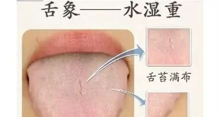 胖人补气,瘦人补血,不论胖瘦都要先补这里! - 第5张 胖人补气,瘦人补血,不论胖瘦都要先补这里! - 第5张