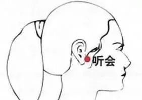 艾灸这三个穴位,对各种眼疾疗效都好! - 第2张 艾灸这三个穴位,对各种眼疾疗效都好! - 第2张