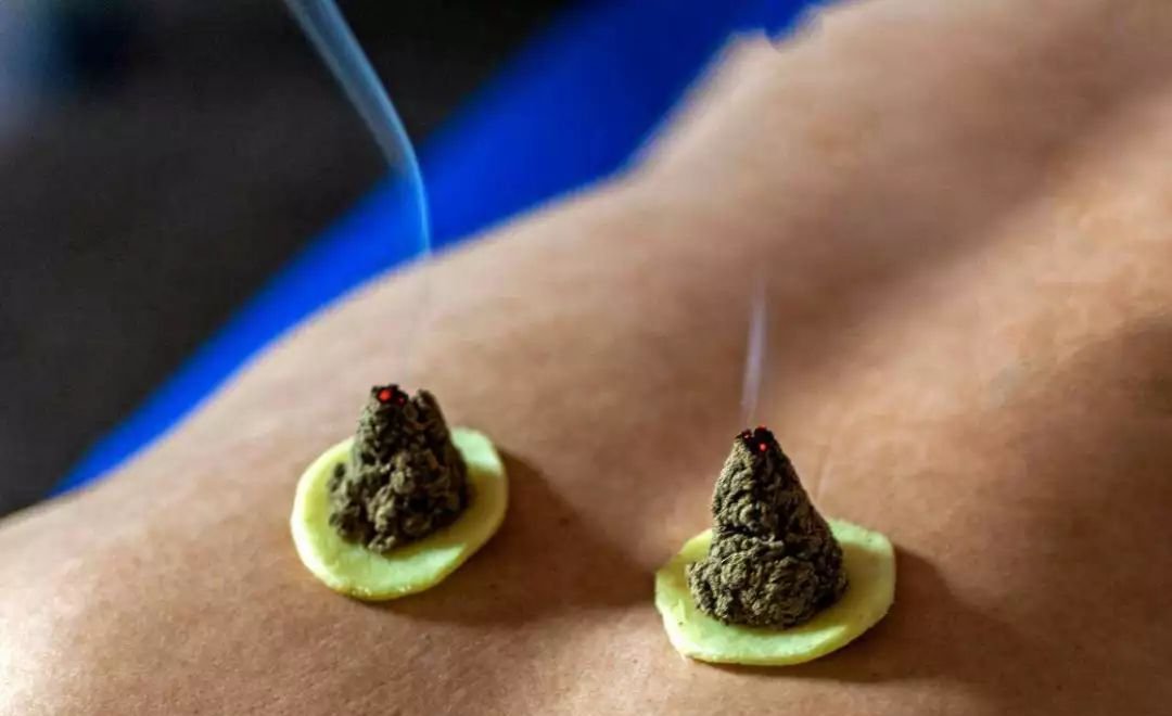 颈肩痛、肩周炎,艾灸取穴大不同,千万别灸错了! - 第4张 颈肩痛、肩周炎,艾灸取穴大不同,千万别灸错了! - 第4张