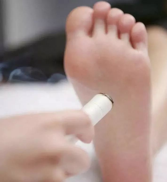 上下不通,重在中焦;表里不和,重在少阳。妙用艾灸,一气贯通! - 第6张 上下不通,重在中焦;表里不和,重在少阳。妙用艾灸,一气贯通! - 第6张