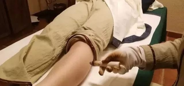 艾灸,不能忘了灸腿,您知道为什么吗? - 第2张 艾灸,不能忘了灸腿,您知道为什么吗? - 第2张