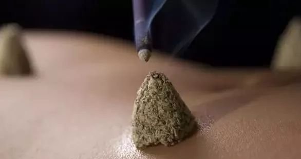 三伏隔姜灸,让温暖透进骨子里——这些病症更能断根 - 第3张 三伏隔姜灸,让温暖透进骨子里——这些病症更能断根 - 第3张