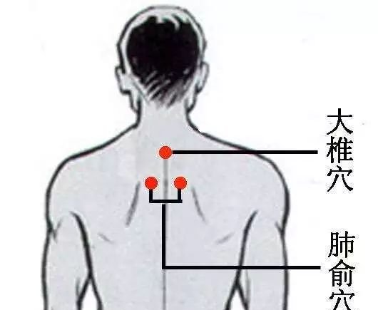 三伏灸都要灸哪里?最完整说明来了,记得收藏 - 第9张 三伏灸都要灸哪里?最完整说明来了,记得收藏 - 第9张