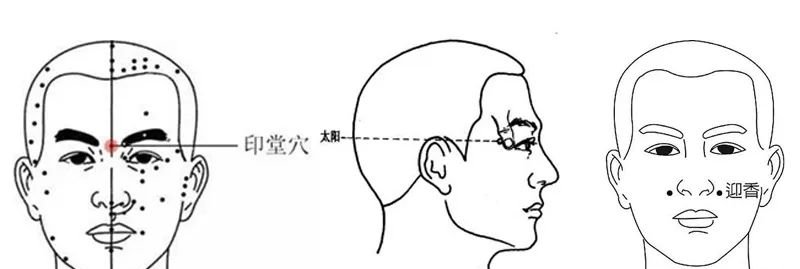 鼻炎就要冬病夏治!此时艾灸,疗效抵过秋冬10倍 - 第7张 鼻炎就要冬病夏治!此时艾灸,疗效抵过秋冬10倍 - 第7张