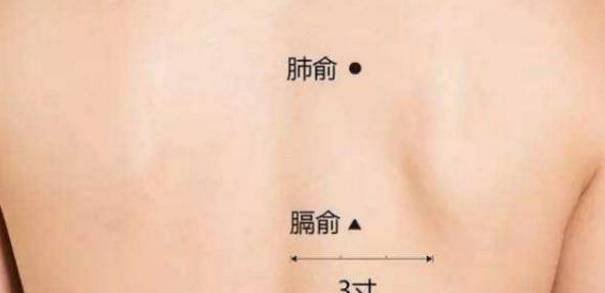 汗从哪里出,病从哪里来!夏天爱出汗的,快对照看看吧! - 第7张 汗从哪里出,病从哪里来!夏天爱出汗的,快对照看看吧! - 第7张